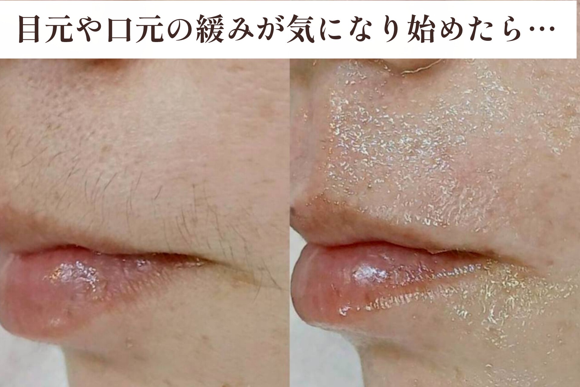 年齢とともに気になり始めた”たるみ”に。フェイシャルワックスで整える、肌の土台ケア【松本市マツエク＆まつげカール専門店LUIRE(ルイール)】