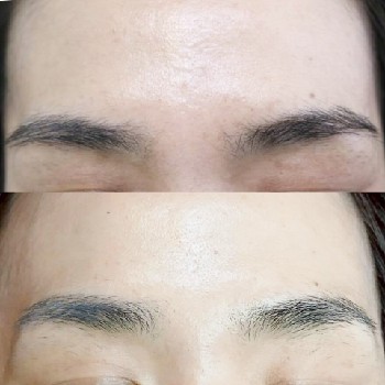 2年継続して眉ワックスに通われているお客様の施術前比較写真。2年前の現在を比べると、自己処理を控えながら眉毛が育ち、自然でバランスの良い眉毛になっている。