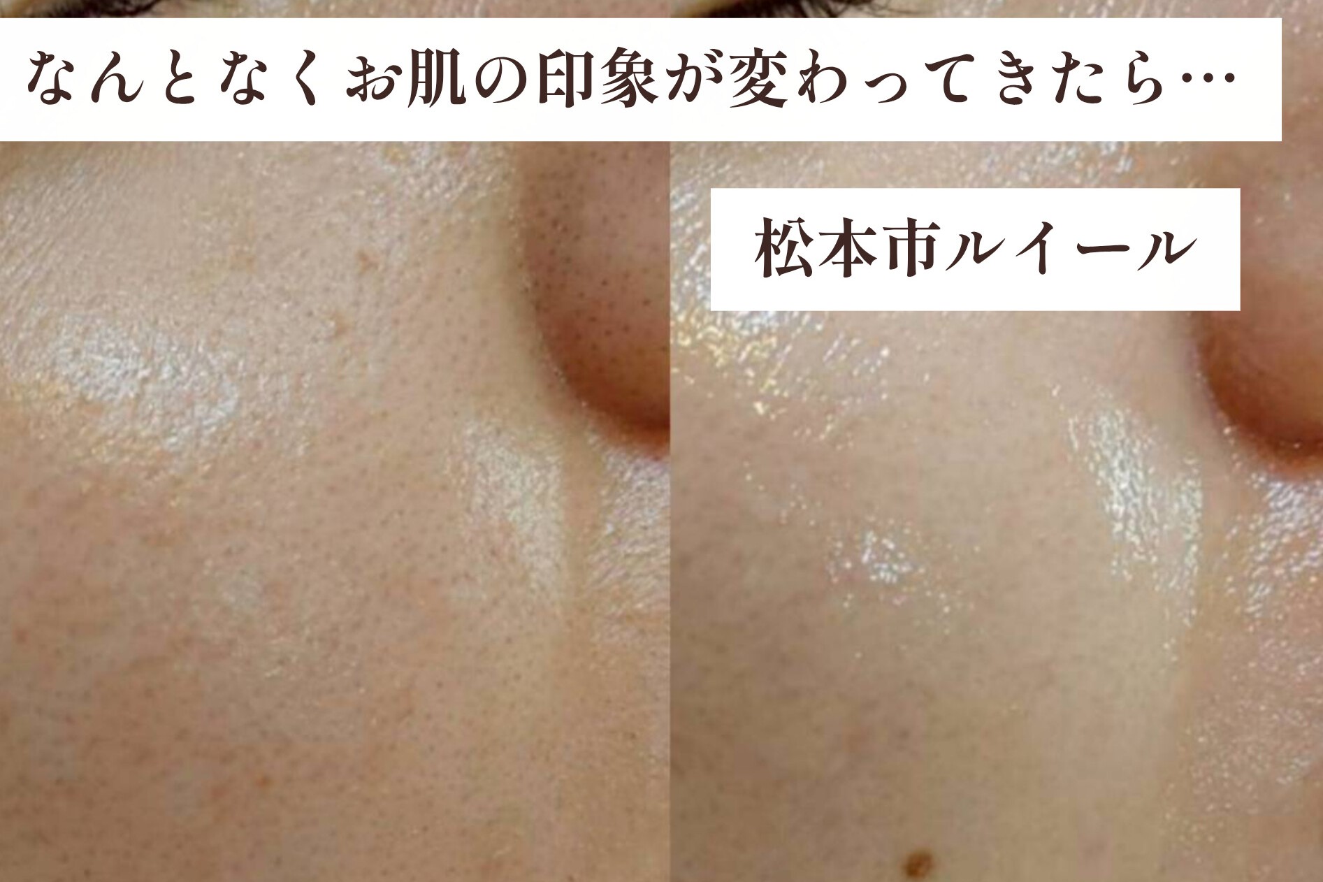 40代こそお顔のワックスがおすすめな理由【松本市マツエク&まつげカール専門店LUIRE(ルイール)】