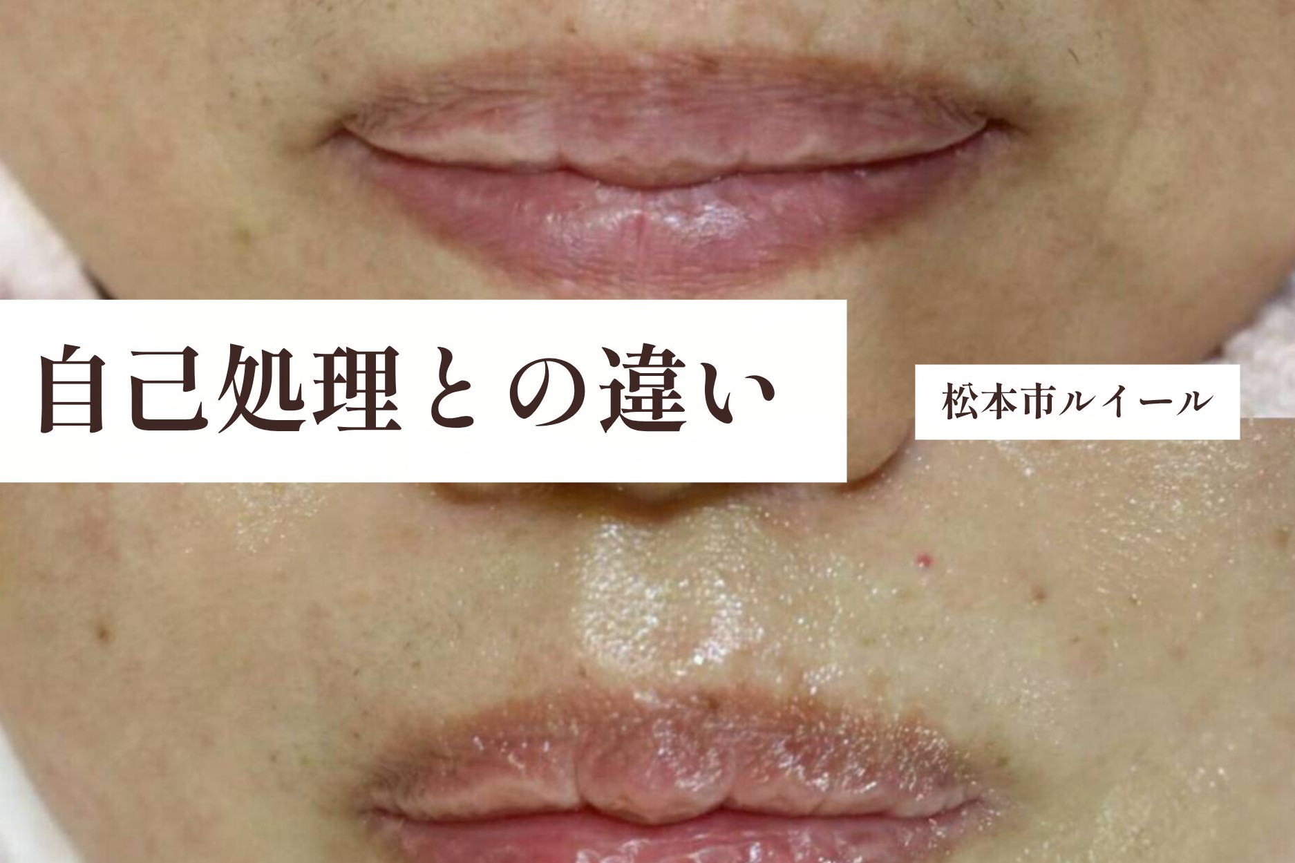 お顔のワックスと自己処理の違いって？それぞれの特徴をご紹介します【松本市マツエク＆まつげカール専門店LUIRE(ルイール)】