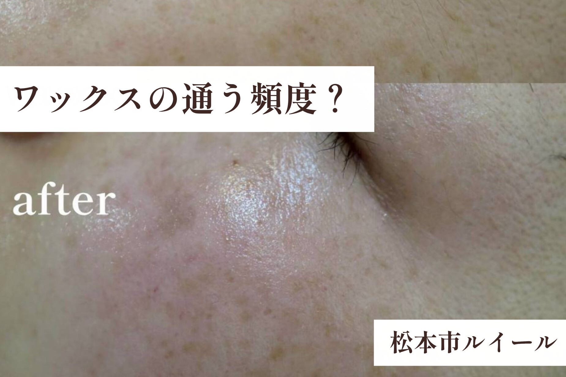 お顔のワックスはどれくらいのペースがおすすめ？【松本市マツエク＆アイブロウワックス専門店LUIRE(ルイール)】
