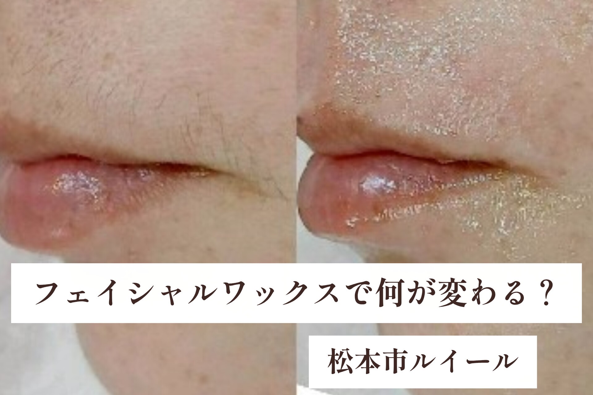 フェイシャルワックスをすると何が変わる?40代が感じる嬉しい変化【松本市マツエク&まつげカール専門店LUIRE(ルイール)】